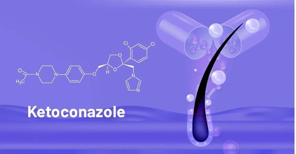 Dầu gội trị gàu ngứa da đầu: Chọn đúng, dùng đúng mới hiệu quả