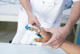 Gãy 3 đốt ngón tay do điện thoại phát nổ khi đang rút sạc