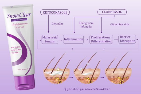 Dầu gội trị gàu Snowclear: Sự lựa chọn thông minh cho người tiêu dùng Việt