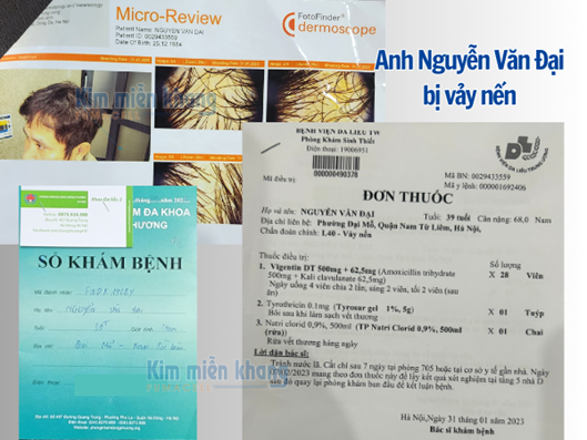 Bị vảy nến toàn thân, Kim Miễn Khang đã cứu nguy cho anh Đại