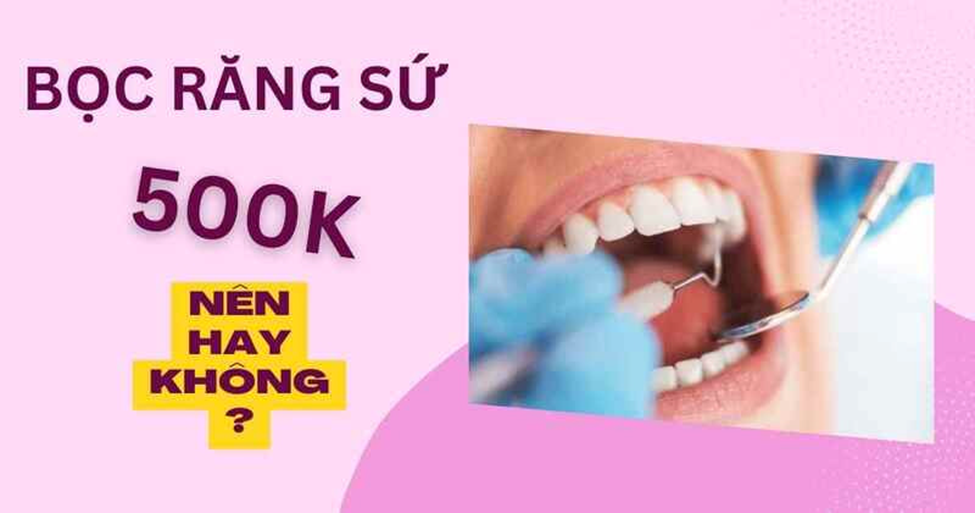 Bọc răng sứ 500K: Ưu đãi có hạn chỉ có tại Nha khoa SGC