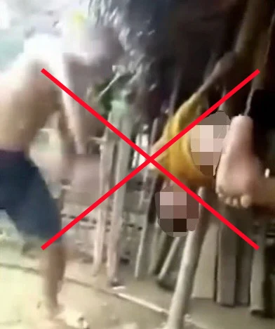 Khẩn trương xác minh, làm rõ và xử lý vụ việc cháu bé nghi bị bạo hành