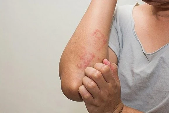 Đậu phụ có nhiều lợi ích cho sức khỏe nhưng ai không nên ăn?