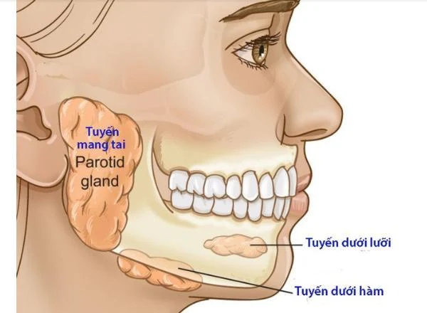 U tuyến nước bọt: Bệnh nhân nên ăn gì, kiêng gì?