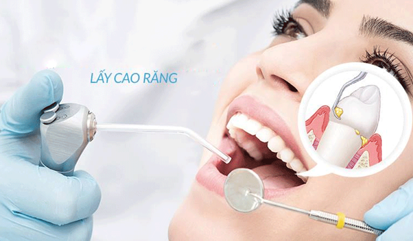 Nha khoa Đăng Lưu - Nha khoa lấy cao răng uy tín, không đau