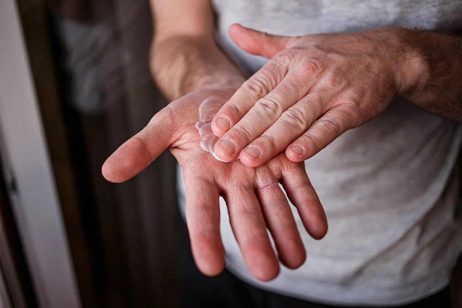 5 bước chăm sóc da khắc phục, ngăn ngừa nứt nẻ mùa hanh khô