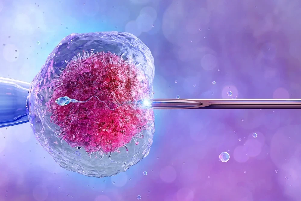 Thụ tinh trong ống nghiệm IVF là gì? Quy trình thực hiện
