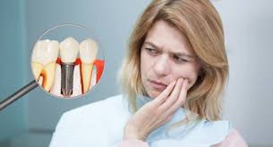 Quá trình trồng răng implant có đau không?