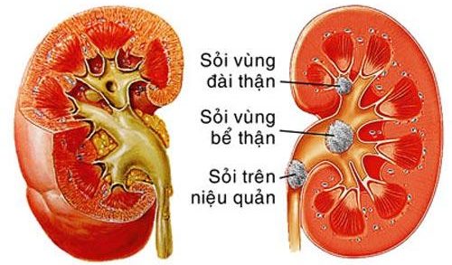 Nguy cơ tiềm ẩn khi không uống đủ nước trong mùa đông