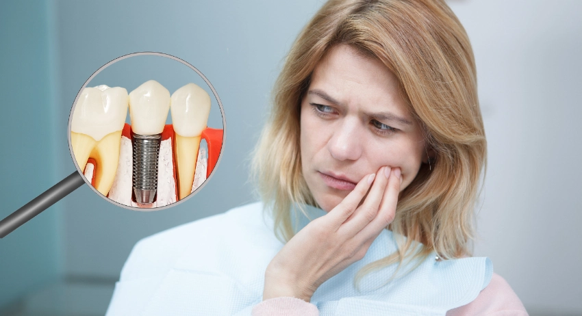 Đánh giá chân thực trải nghiệm trồng răng Implant