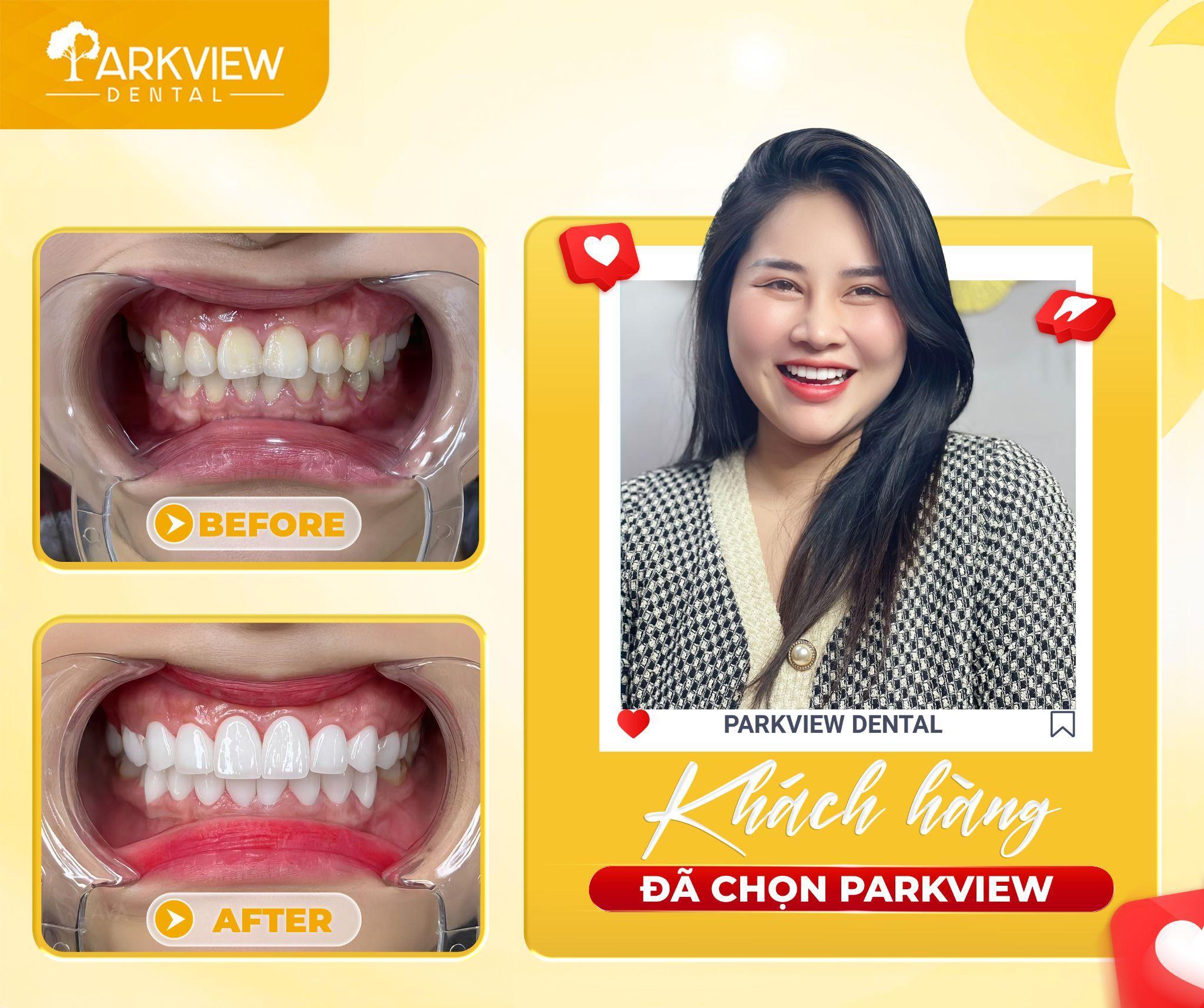 Parkview Dental - Dịch vụ nha khoa tổng quát hàng đầu tại TP.Hồ Chí Minh