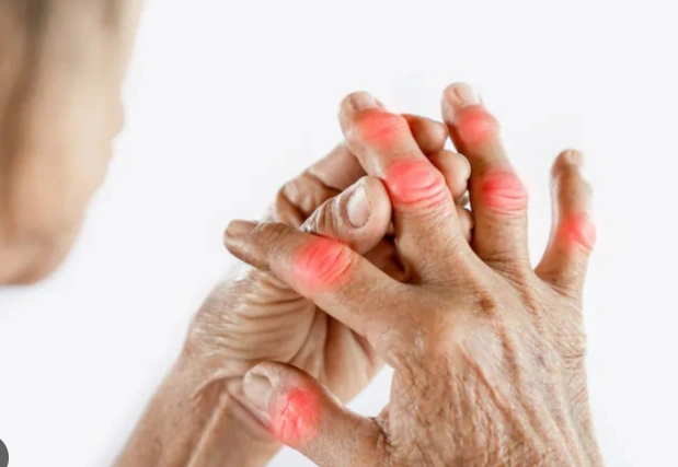 Mắc viêm khớp dạng thấp có uống được cà phê?