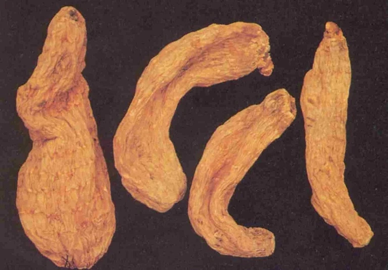 5 vị thuốc phòng và trị rối loạn tiền đình