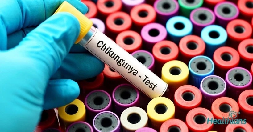 WHO cảnh báo nguy cơ lây lan cao của virus Chikungunya