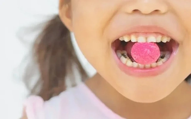 7 loại thực phẩm làm tăng nguy cơ sâu răng bạn nên biết để tránh