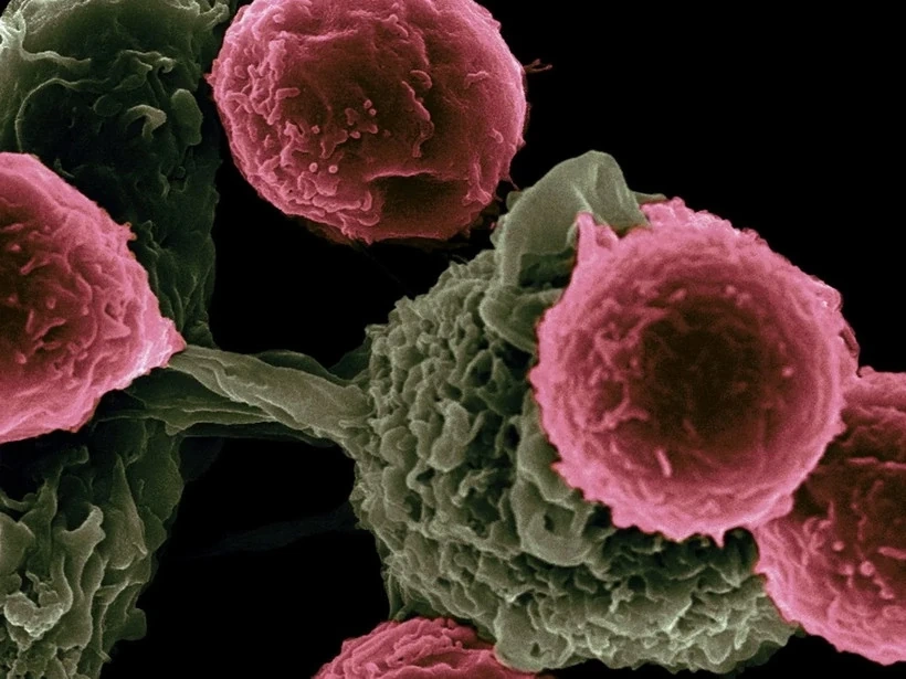 Australia phát triển liệu pháp miễn dịch mới cho ung thư máu hiếm gặp