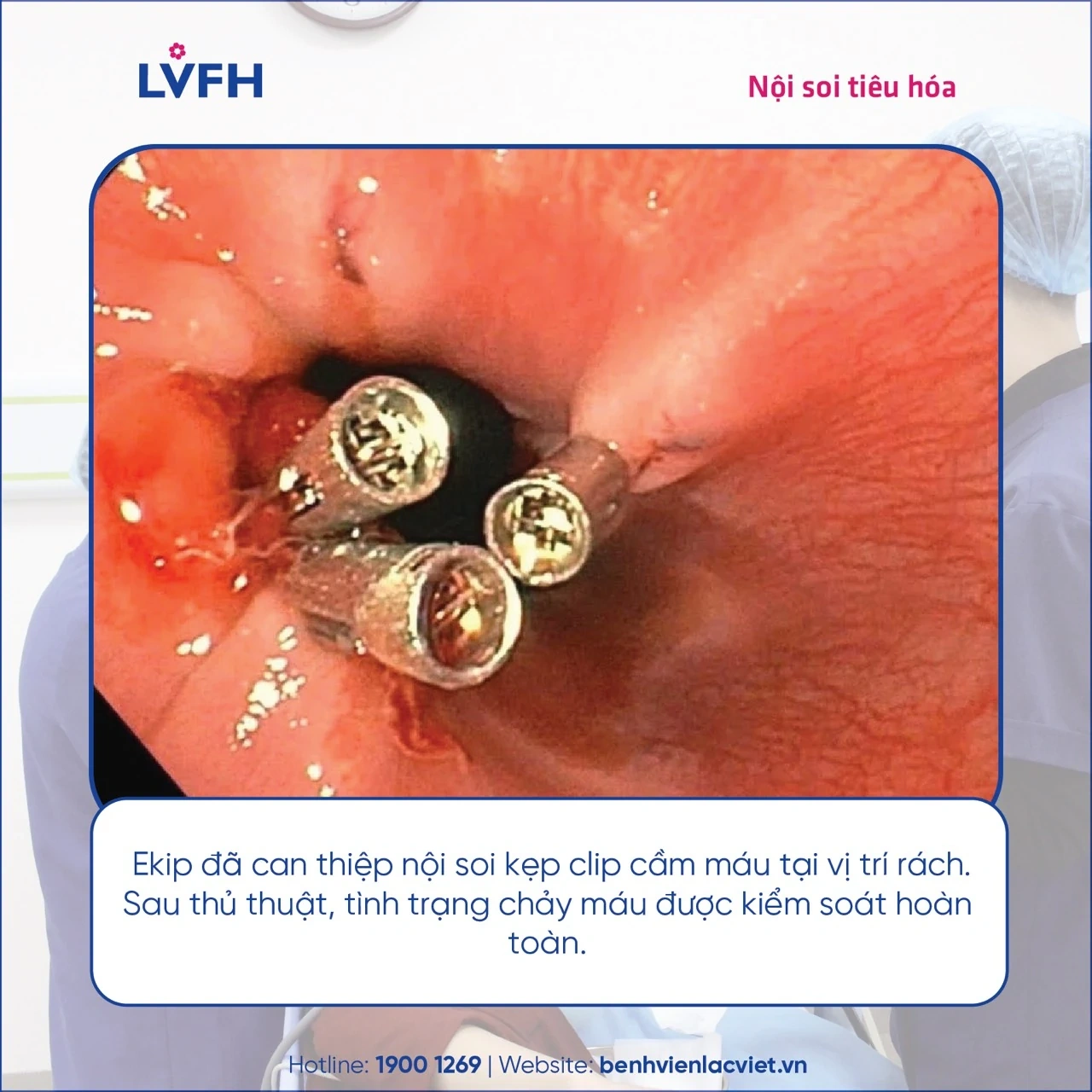 Kịp thời cấp cứu, điều trị thành công bệnh nhân nam 25 tuổi rách tâm vị chảy máu