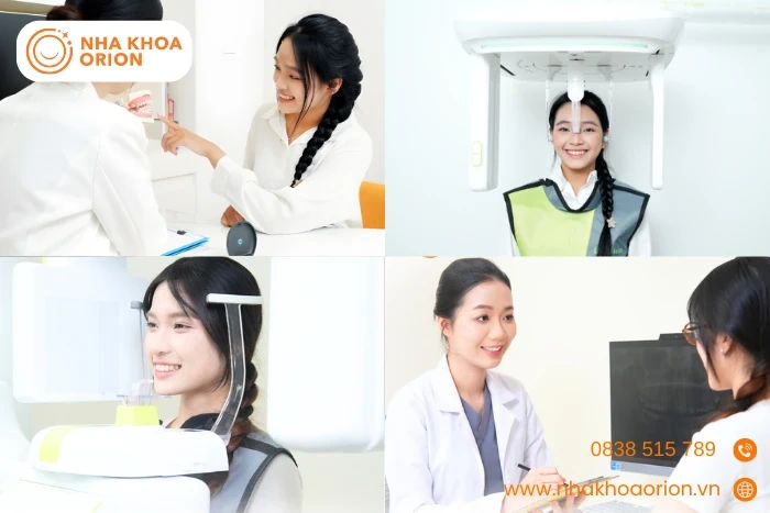 Nha khoa Orion - Địa chỉ cấy ghép Implant uy tín, chất lượng cao