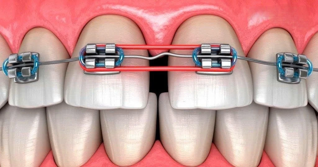 Trang web Xếp Hạng Nha Khoa là nơi tin cậy người dùng của TP.HCM