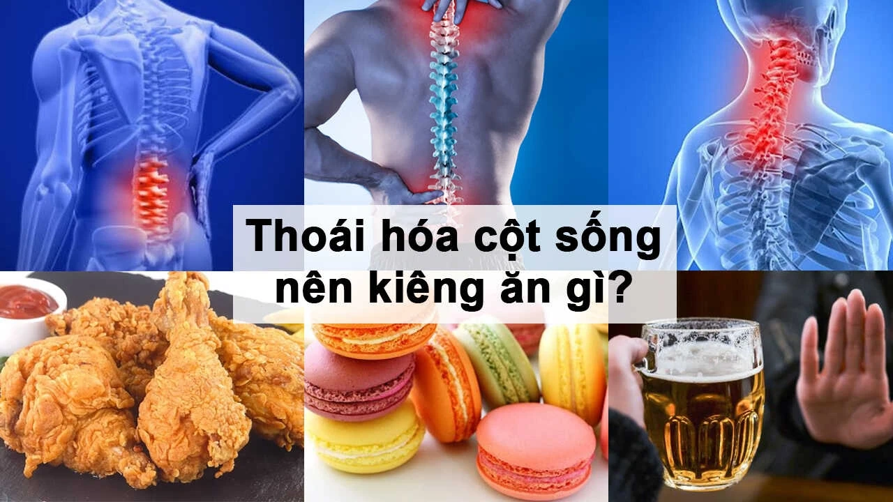 Những món ăn tốt nhất cho người bị thoái hóa cột sống