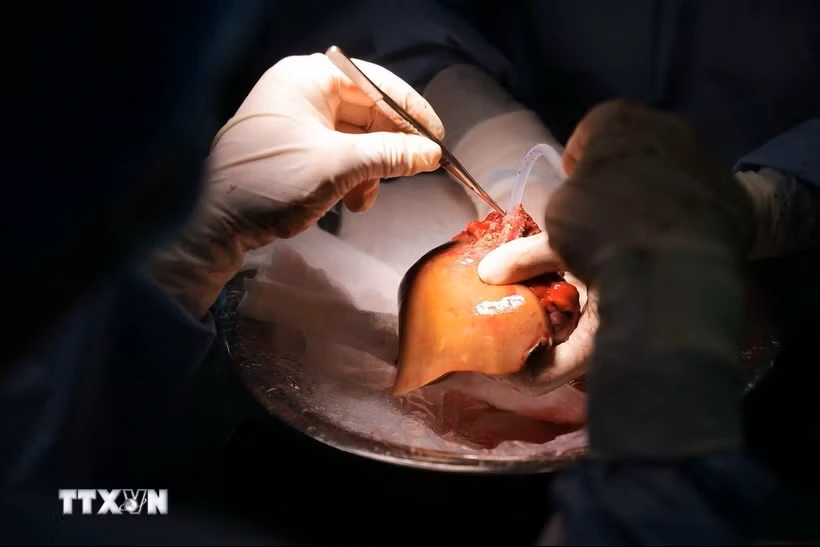 Bỉ tìm ra hướng đi mới trong điều trị ung thư gan di căn