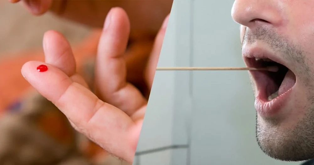 Xét nghiệm ADN thai nhi cần chuẩn bị những gì?