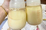 Phân biệt màu sữa mẹ an toàn và dấu hiệu cần cảnh giác