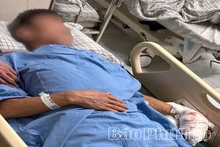 Quên ngắt điện khi lau máy ép nước mía, người đàn ông bị cuốn dập bàn tay