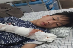 Cậu học trò bị đứt gân tay, nỗ lực tập phục hồi, chinh phục kỳ thi tuyển sinh vào lớp 10