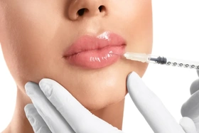 Tiêm Filler môi trái tim là gì? Lý do nên tiêm môi hình trái tim