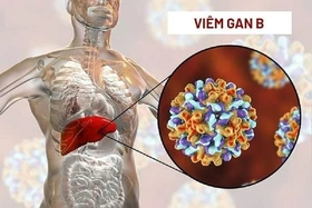 Chế độ ăn người bệnh viêm gan B cần biết