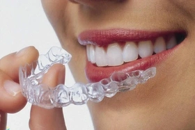 5 lý do niềng răng Invisalign được ưa chuộng tại Nha khoa Quốc tế Phú Hòa