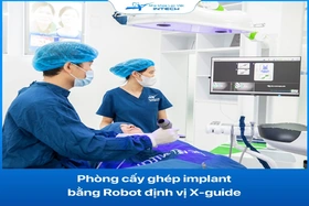 3 Cách Giảm Đau Hiệu Quả Khi Cấy Răng Implant