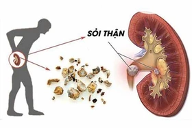 3 loại đồ uống lành mạnh hỗ trợ chức năng thải độc cho thận