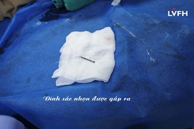 Căng mình giành lại sự sống cho bệnh nhi 8 tuổi nuốt phải đinh