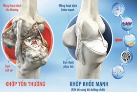 5 khớp trên cơ thể dễ bị thoái hóa