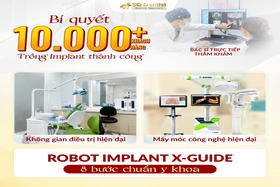 Làm răng Implant tại Việt Nam có an toàn không? Giải đáp 7 thắc mắc lớn nhất của Việt kiều trước khi về nước