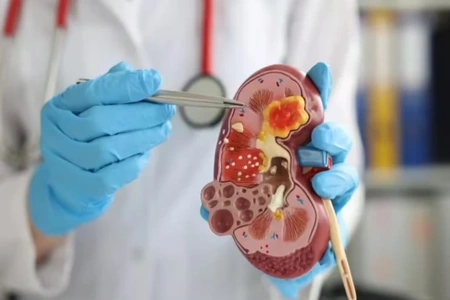 3 lý do khiến thận dễ suy kiệt vào mùa lạnh