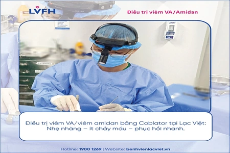 Điều trị viêm va, viêm amidan bằng coblator tại Lạc Việt: Nhẹ nhàng - ít chảy máu - phục hồi nhanh