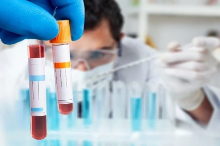 Sốt xuất huyết diễn biến khó đoán, nhiều ca chuyển nặng nhanh