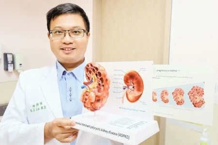 Bác sĩ cảnh báo nguy cơ suy thận nghiêm trọng từ chứng cao huyết áp