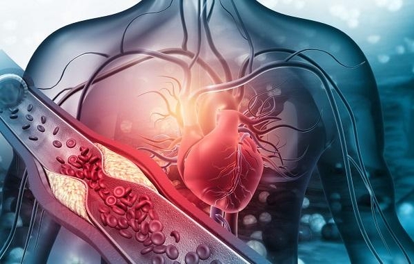 Bí quyết ăn uống giúp giảm cholesterol hiệu quả nhất