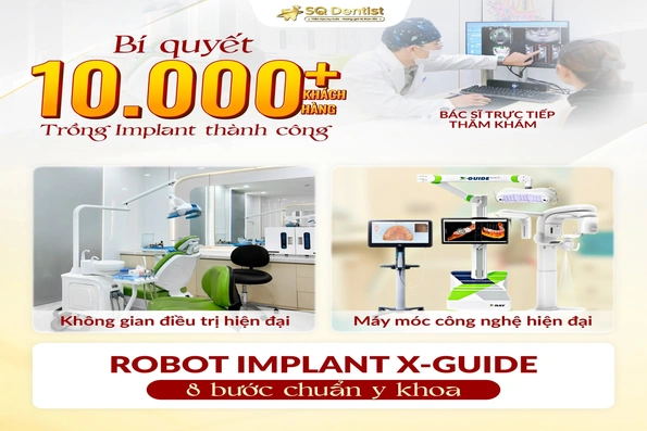 Làm răng Implant tại Việt Nam có an toàn không? Giải đáp 7 thắc mắc lớn nhất của Việt kiều trước khi về nước