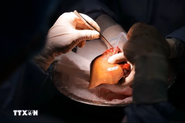 Bỉ tìm ra hướng đi mới trong điều trị ung thư gan di căn