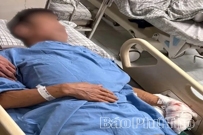 Quên ngắt điện khi lau máy ép nước mía, người đàn ông bị cuốn dập bàn tay